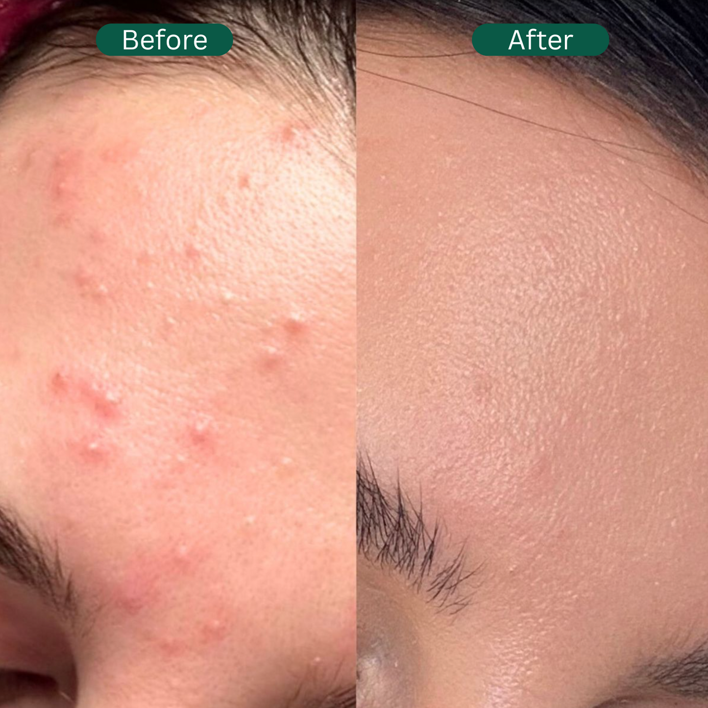 Lira I Oxygen-Basil Fusion Mask
