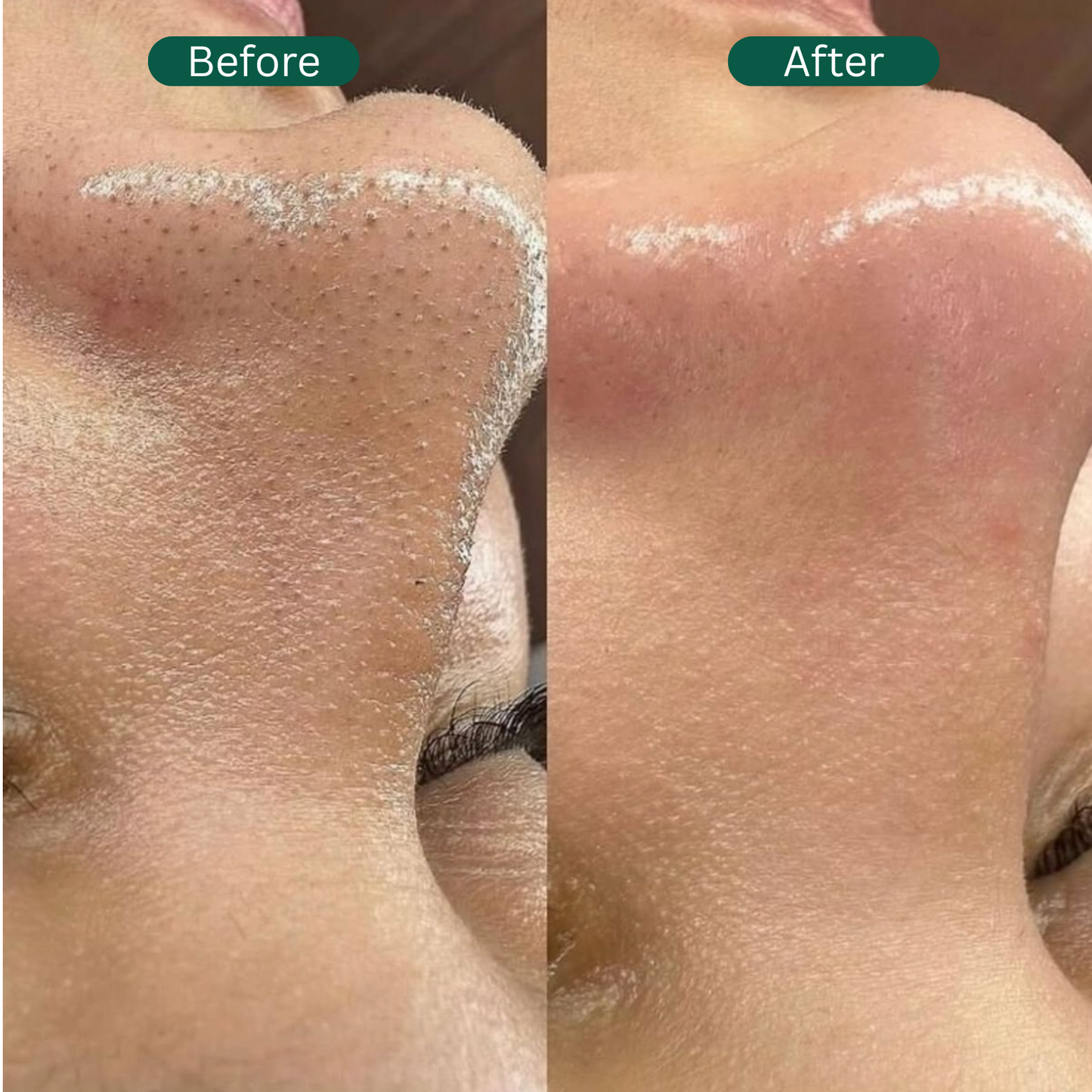 Lira I Oxygen-Basil Fusion Mask